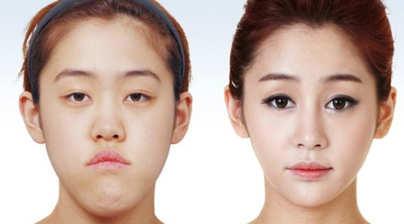 korean-plastic-surgery.